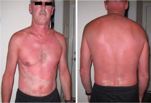 Keith Siau tweet media