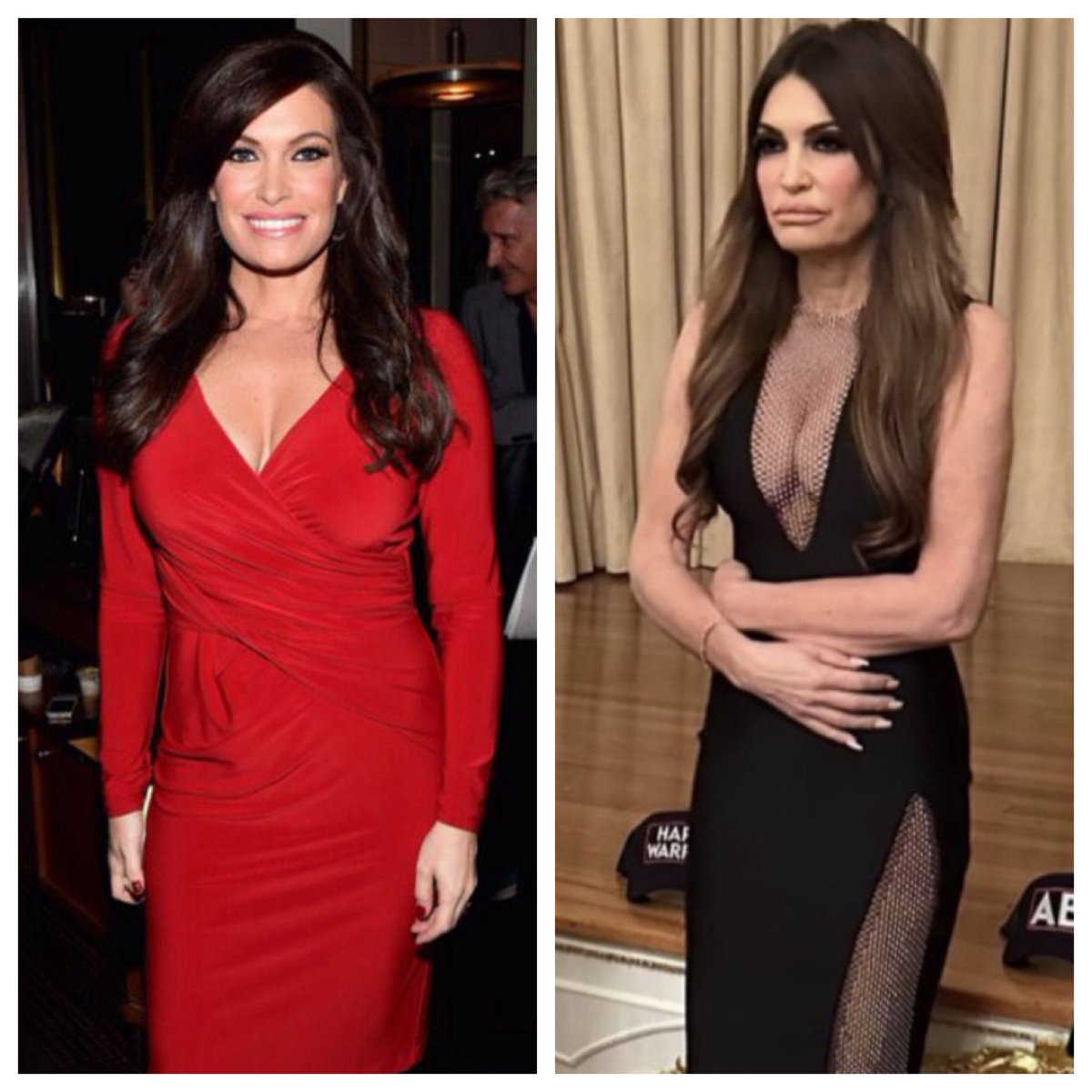 How it started, how it’s going. This is what happens when you drink too much MAGA cool aid. Don Jr. got her hooked on the hard stuff. The best has come and gone. All jokes aside… Kimberly Guilfoyle does not look well at all. Somebody needs an intervention.