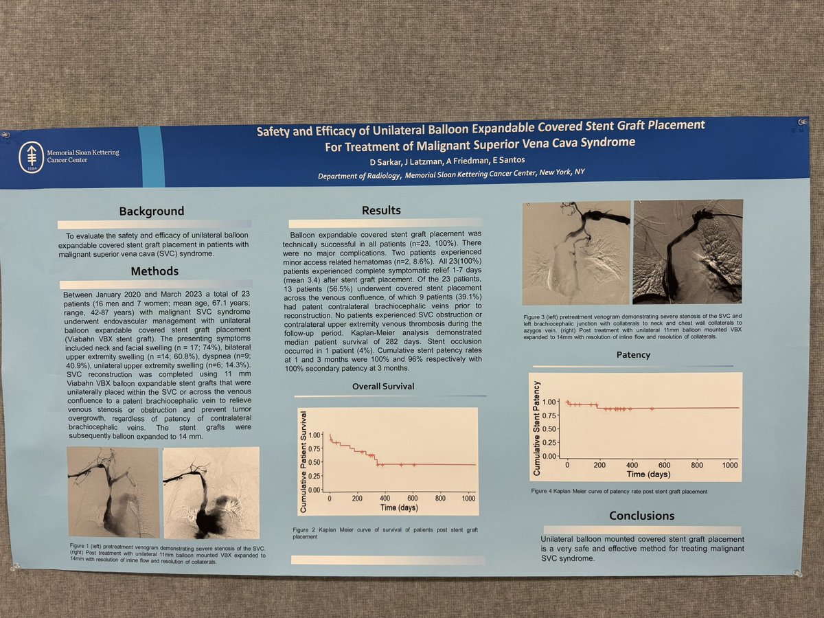 Complex upper malignant SVC syndrome may only need unilateral treatment. #SIRSLC24