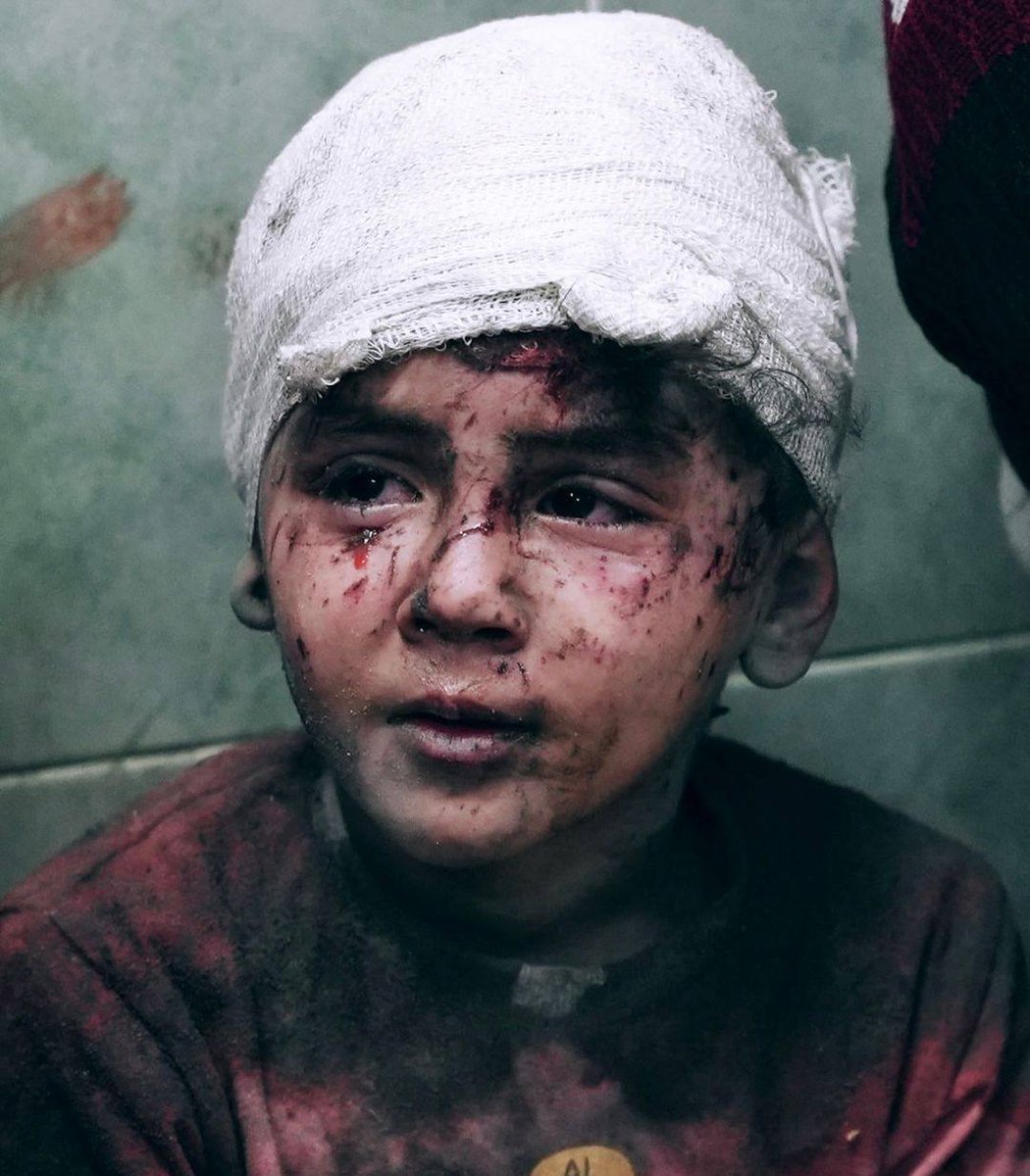 islamasalya88's tweet photo. Ümmetin dünya sevgisinin ve korkaklığının bedelini Gazzeli çocuklar ödüyor... https://t.co/wJ8yuVcEYJ