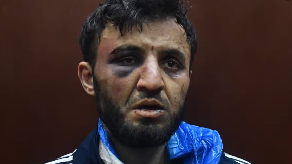 AlertaNews24's tweet photo. 🇷🇺 | ATAQUE EN RUSIA: LO QUE SE SABE SOBRE LOS SOSPECHOSOS DE TERRORISMO EN MOSCÚ:

1. Dalerjon Mirzoev - CONFESADO - 32 años, inmigrante ilegal de Tayikistán, visa de trabajo vencida, padre de 4 niños pequeños.

2. Saidakrom Rachabalizoda: 28 años, supuestamente nacido en Tayikistán, vive en Moscú.

3. Shamsiddin Fariduni - 24 años, nacido en Tayikistán, trabajador de una fábrica, padre de un bebé de 8 meses.

4. Muhammadsobir Fayzov - Peluquero, llegó en camilla a la corte.

Según se informa, todos han sido acusados ​​en virtud de la "Ley Terrorista" de Rusia por su presunta participación en el ataque terrorista al Ayuntamiento de Crocus.

 La pena máxima es cadena perpetua.