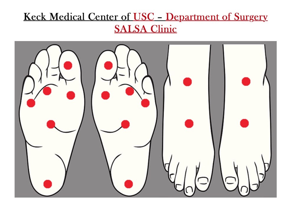 Do you prescribe thermometry for your diabetic foot patients? Here's a printable foot map and daily diary for them. @KeckMedUSC #FightOn #ActAgainstAmputation diabeticfootonline.com/2015/09/09/do-…