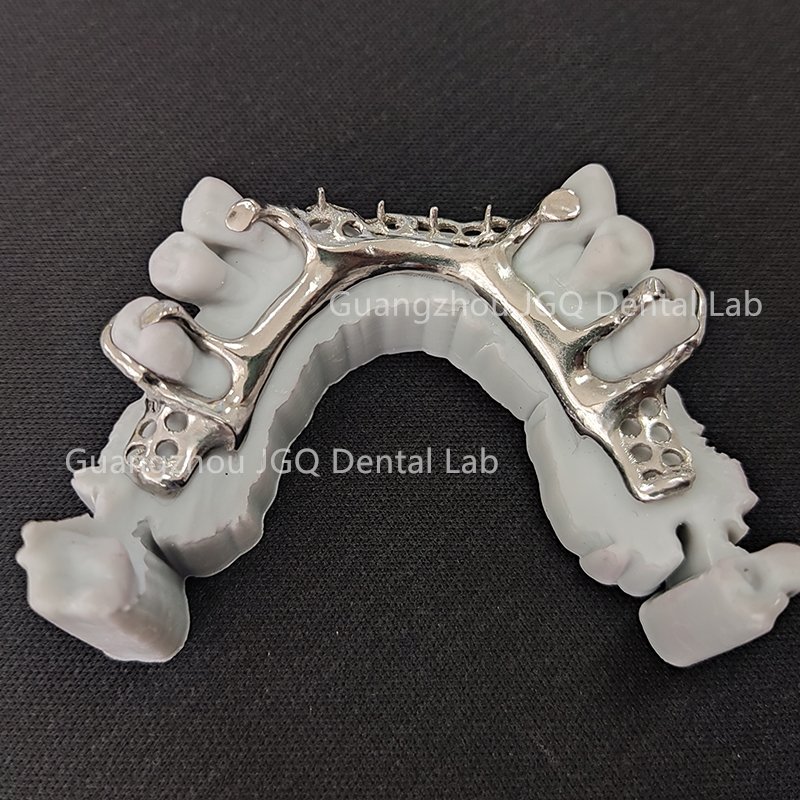 ZhaoJason57098's tweet photo. Titanium alloy framework

3d print ,fast 
Perfect fit
Co-cr alloy avaliable

Guangzhou JGQ Dental Lab
-- Your best outsourcing partner
https://t.co/hf4UpduI5J

#dentistry #dentallab #dentalcrown #metalframe #titaniumframe #digitaldental #3dprinting https://t.co/JjDqYXOOVM