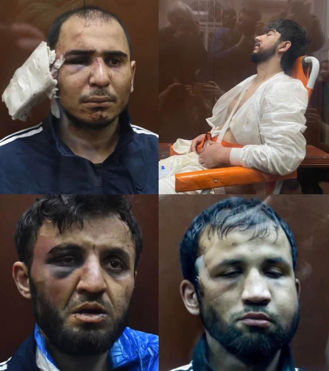 MarkWRowley's tweet photo. Moscow islamist terrorists appear in court.

One is literally unconscious in a wheelchair and the others are visibly banged up, with one having his ear sliced off and fed to him in a video circulating online.

If this treatment had been dished out by the IDF, there would be global protests, calls for ceasefire, and a case lodged at the ICJ 🤭

137 people were killed, including three children, and more than 150 injured.