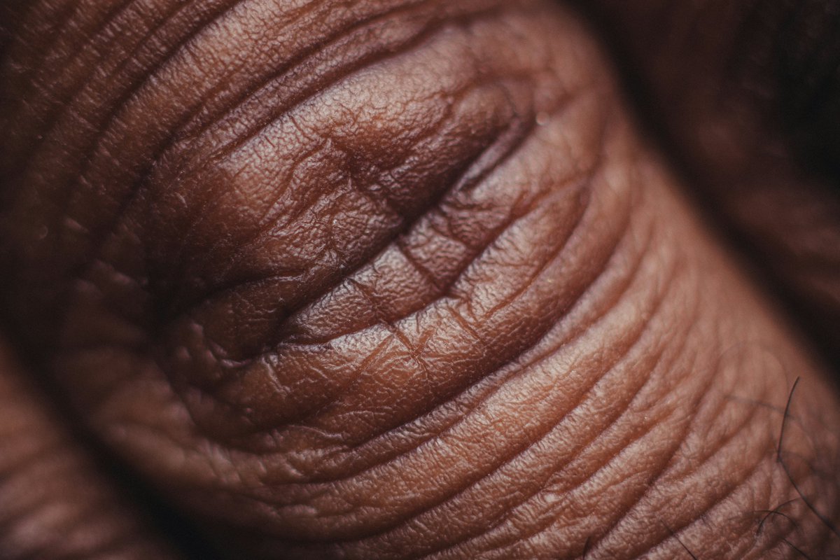 Did you know that #aging might related to genes' length❓

<a href="/TrendsGenetics/">Trends in Genetics</a> reported that a Dutch #research team has published a paper about the relationship between aging and genes' length.

#GenomeFi genetic kits will be able to analyze people's aging degree.

#genome
