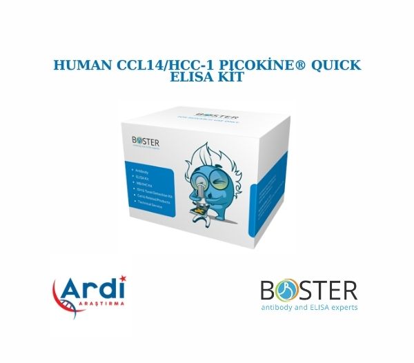 Human CCL14/HCC-1 PicoKine® Quick ELISA Kit 🚀

⚡SKU:FEK1123
⚡Boyut: 96 kuyu/kit, çıkarılabilir şeritler ile.
⚡Reaktif Türler: İnsan
⚡Uygulama: ELISA
⚡Örnek Türleri: hücre kültürü süpernatantları, hücre lizatları, serum ve plazma (heparin, EDTA)
⚡Test Süresi: 90 Dakika