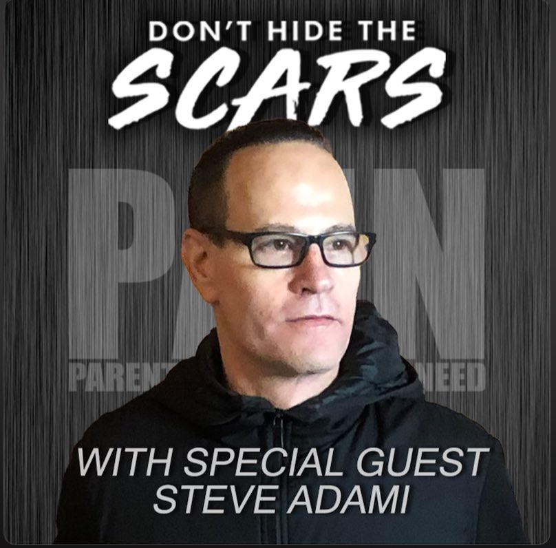 Visit PAINnonprofit.org for Don’t Hide The Scars with special guest @SteveAdami, executive director of @TheWayOutSF, a recovery-focused homeless initiative of The Salvation Army San Francisco. #hope #wedorecover #sober #addiction #recovery #sobriety #abstinence