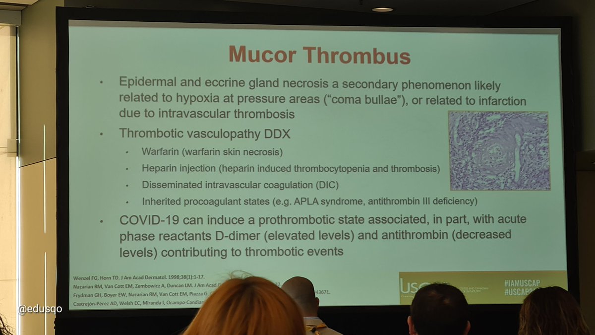 Eduardo Alcaraz, MD PhD (@edusqo) on Twitter photo #DermPath at #USCAP2024 with Drs. Cornejo <a href="/KMCornejoMD/">Kristine M Cornejo MD</a> and Nazarian <a href="/RosNazarianMD/">Rosalynn Nazarian MD</a> <a href="/MGHPathology/">MGH Pathology</a> <a href="/MGHMedicine/">MassGeneral Medicine</a>. Great topics and cases 😍 #DermPath at #USCAP2024 with Drs. Cornejo <a href="/KMCornejoMD/">Kristine M Cornejo MD</a> and Nazarian <a href="/RosNazarianMD/">Rosalynn Nazarian MD</a> <a href="/MGHPathology/">MGH Pathology</a> <a href="/MGHMedicine/">MassGeneral Medicine</a>. Great topics and cases 😍