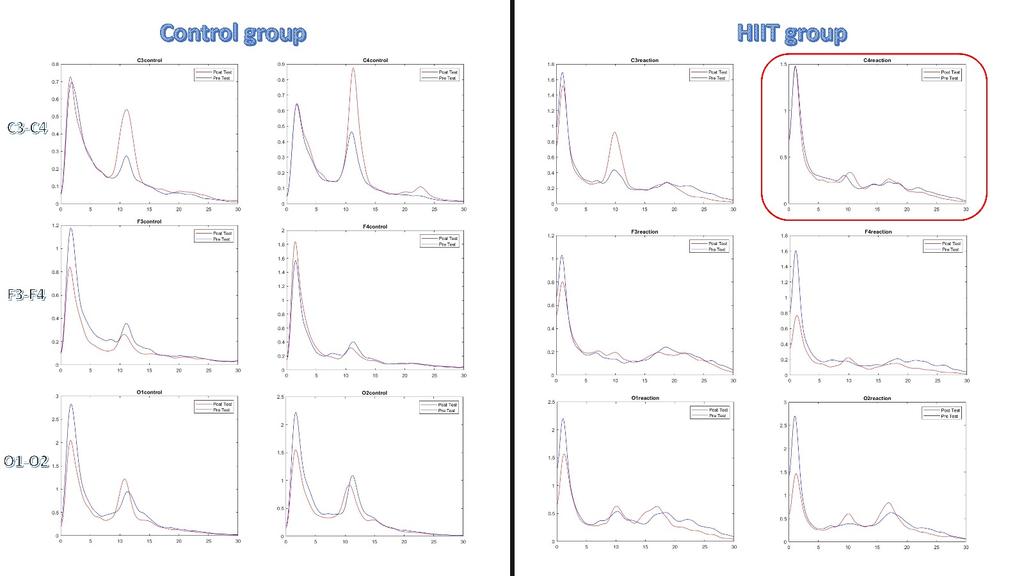 BatuhanDirik's tweet photo. Mu rhythm was suppressed in the right hemisphere immediately after HIIT training. https://t.co/3KYBkcdUYO