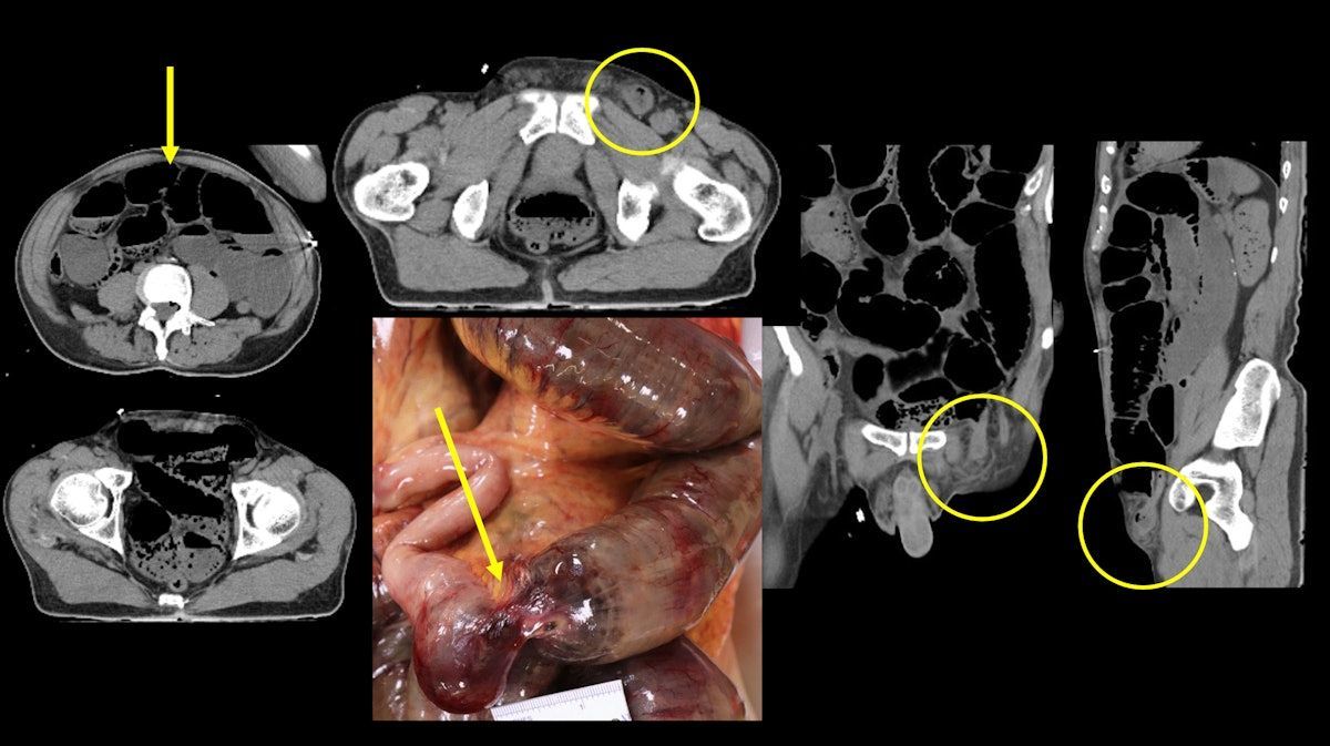 Radiologists, RTs, and the art of forensic imaging #radiology <a href="/JamieElifritzMD/">Jamie Elifritz</a> <a href="/GurnickAcademy/">Gurnick Academy</a> buff.ly/3vhkahP