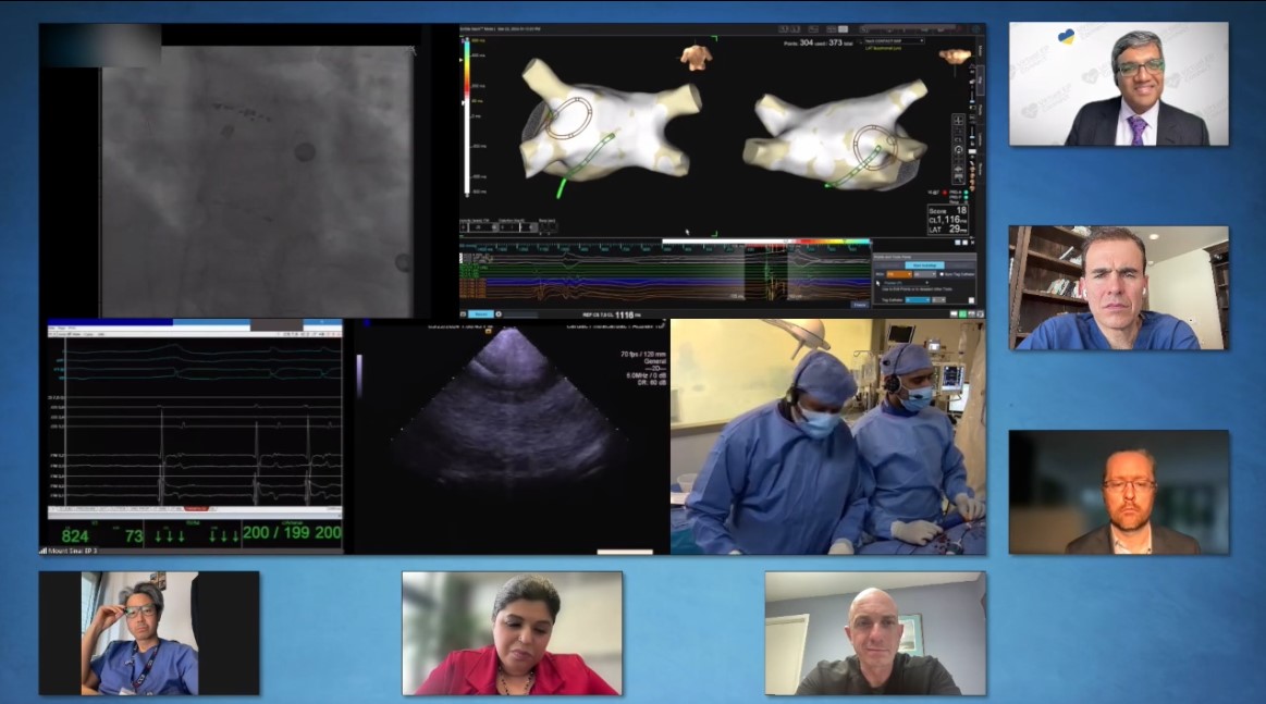 #EPeeps Now Available in @ConnectEp On-Demand Library. Live PFA for AF Case performed by Srinivas Dukkipati from @MountSinaiHeart EP lab with engaging discussions between @VivekReddyMD @jongichun Frank Cuoco, @drjohndayMD @Drdevignair @KarsNeven Access @ epconnect.live/pfacase