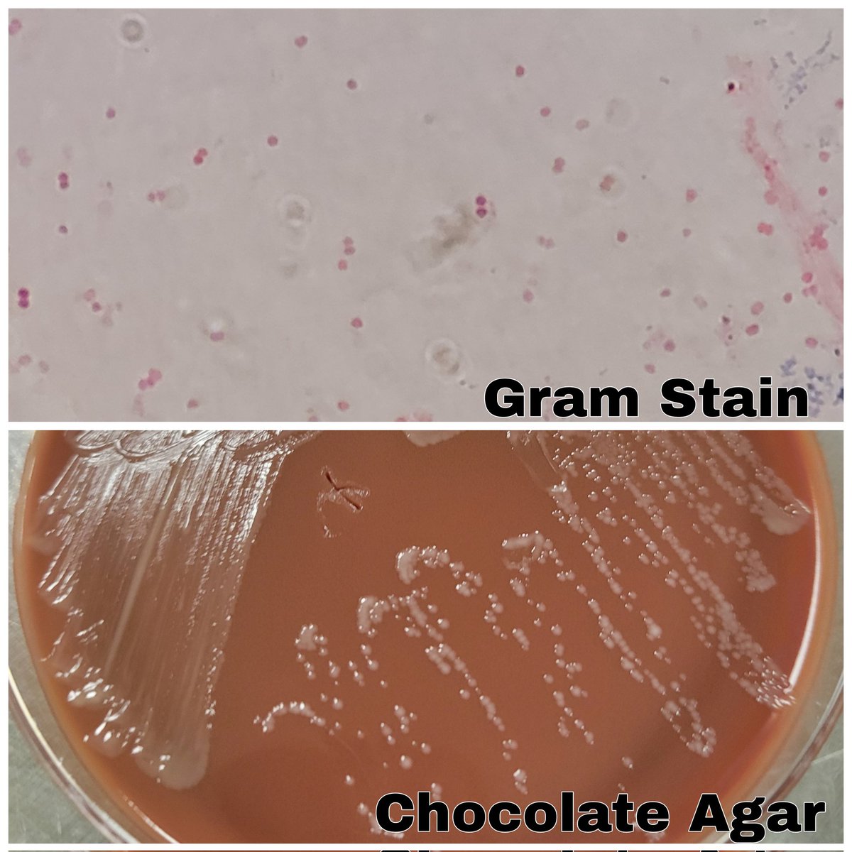 🍫Only grows on chocolate agar, not blood agar or MacConkey 🐂 Oxidase positive 😺 Catalase positive Who am I and how do you distinguish between the species in this genus?