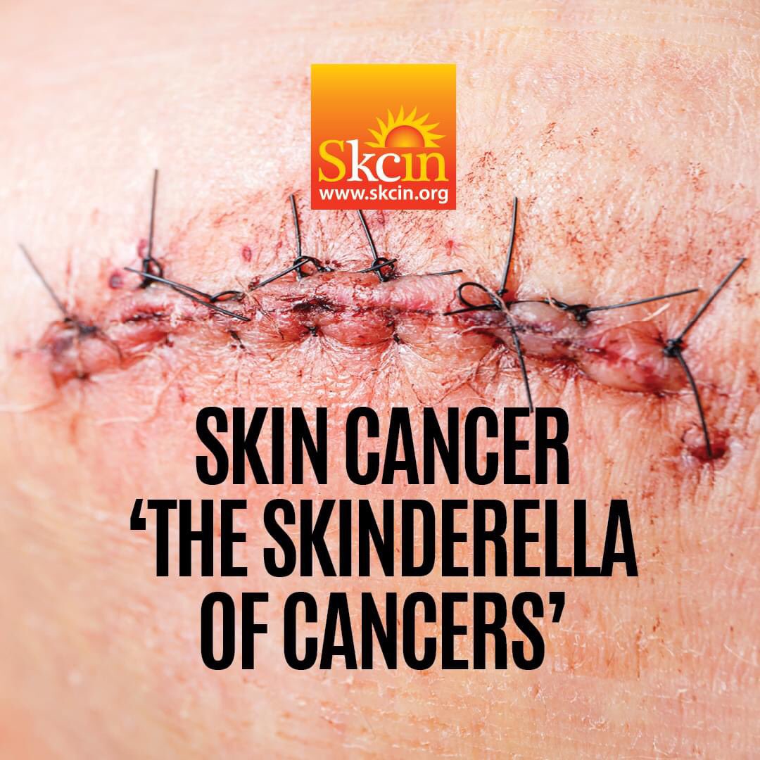 Skin cancer’s a major public health concern,more commonly diagnosed than all other malignancies combined,overlooked by government intervention considering 90% of cases are preventable!1 in every 3 cancers diagnosed is skin cancer with figures expected to reach over 400000 by 2025
