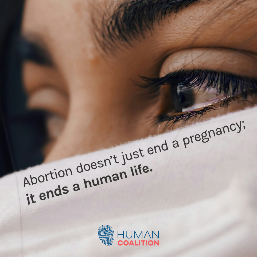 Abortion takes away and leaves nothing in return. #SaveTheBabyHumans #LifeIsAHumanRight #ValueLife #ChooseLife #EndAbortion #Abortion #ProLife #RescueThePreborn #HelpHurtingWomen #HelpTheHurting #HelpTheVulnerable #Preborn #RestoreFamilies