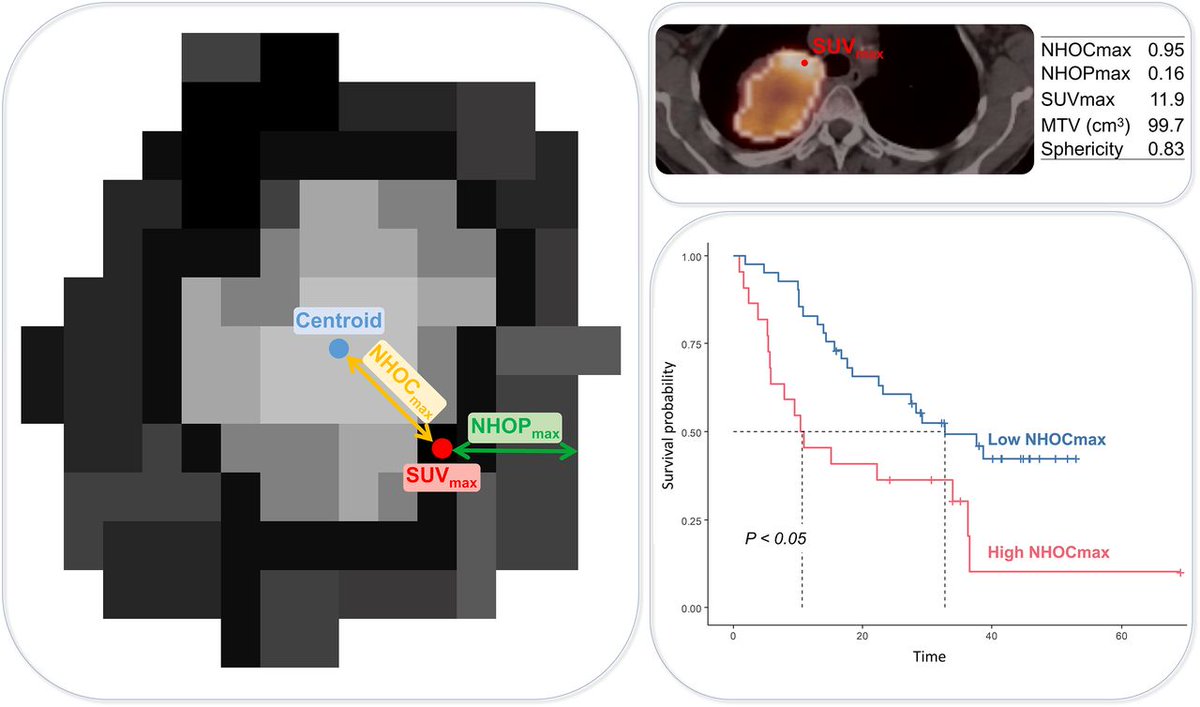 Promising candidate prognostic biomarkers in ¹⁸F-FDG PET images: Evaluation in independent cohorts of non–small cell lung cancer patients. ow.ly/ez6m50QUo2A #NuclearMedicine #NSCLC #MolecularImaging @LitoCurie @IreneBuvat