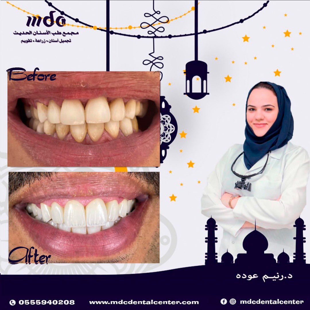 MDCDentalCenter's tweet photo. https://t.co/Erphx8PuDO