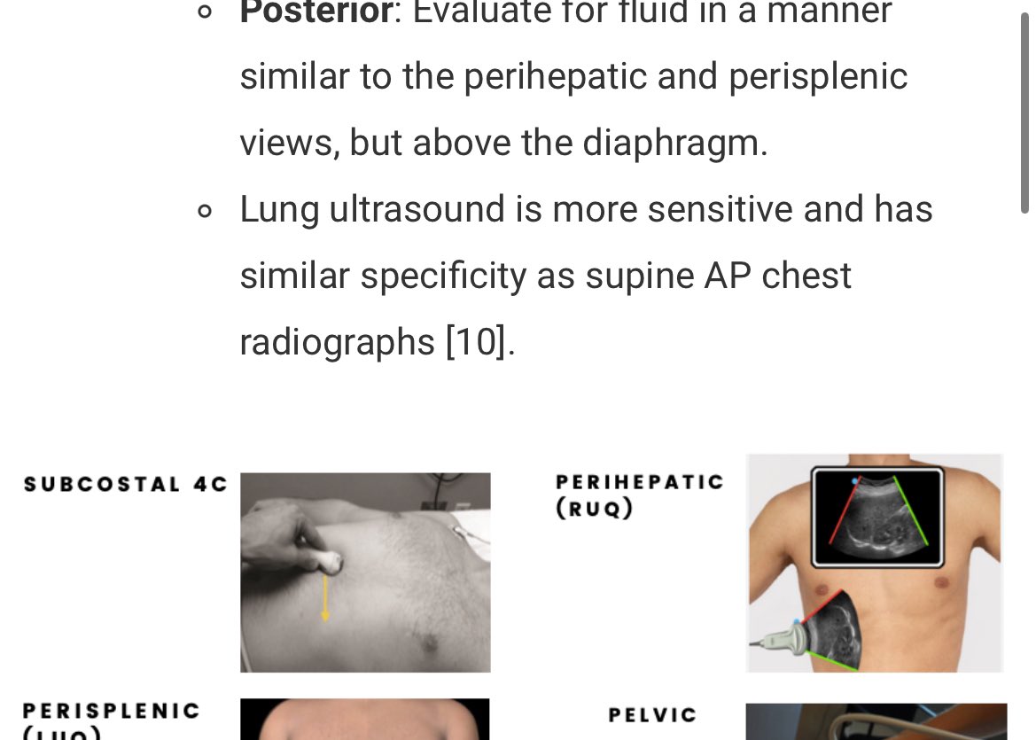 Sign up for our free educational newsletter to get the Spring issue which includes a summary of Trauma in Pregnancy! This issue covers the basic approach to trauma, including tips for the eFAST exam! safepartum.com/email-list