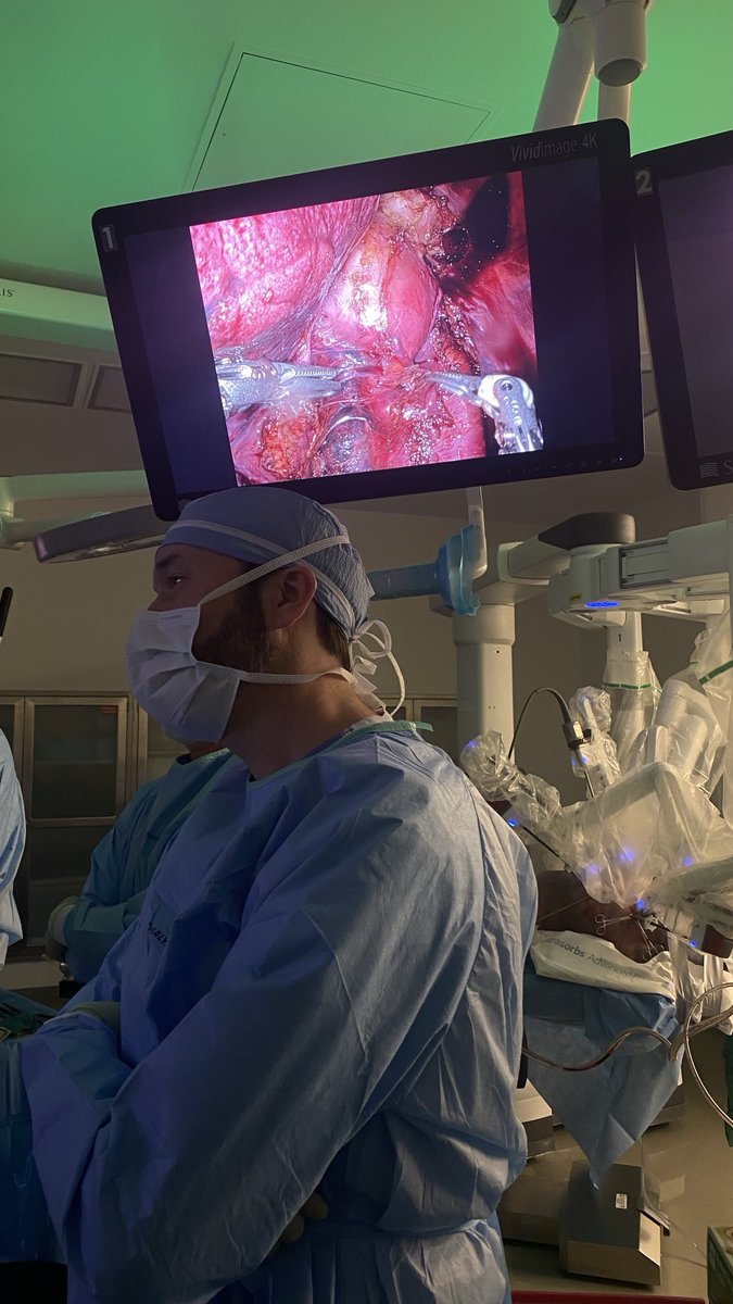 Robotic exposure thoracic aorta. From Innominate to hiatus. #vascularrobotics