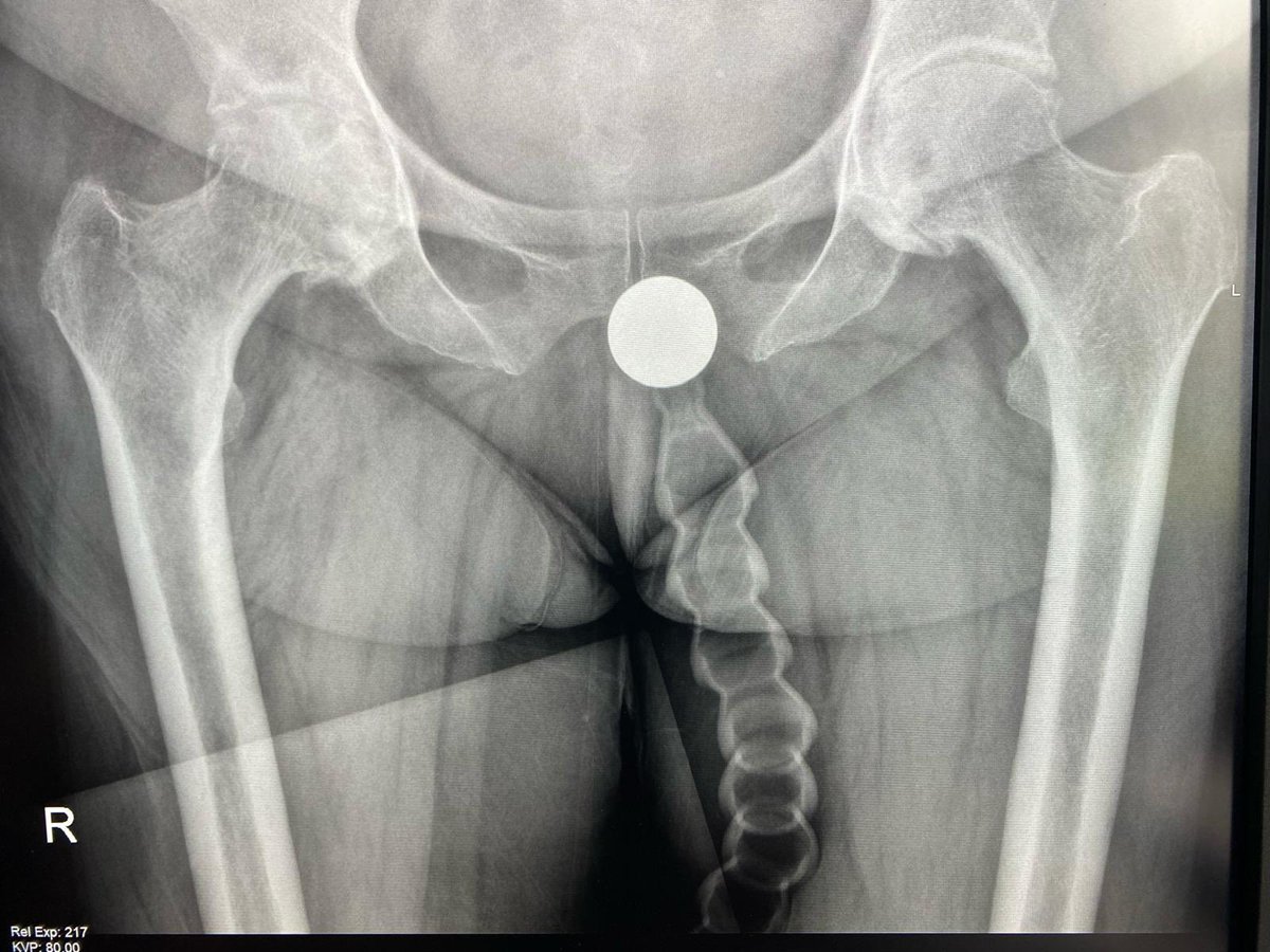 Paul McCoubrie tweet media