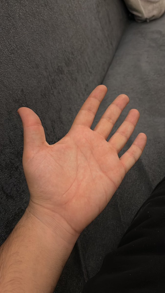 cikolataliboyoz's tweet image. Herkes dalga geçerdi benle küçükken kız eli gibi elin var diye o yüzden böyle çektim 😁 #elchallenge