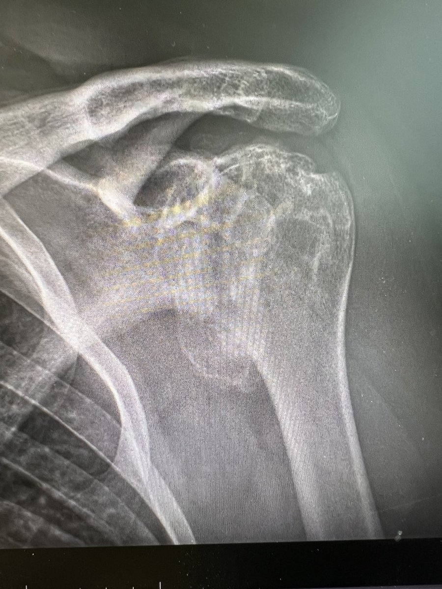 Tim Lenters, MD tweet media