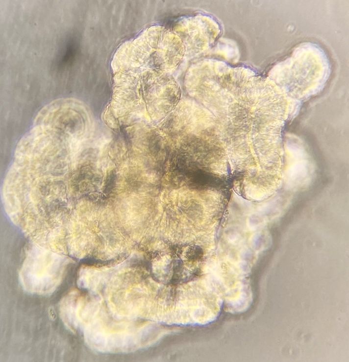 Just a happy preterm infant enteroid growing all alone. #preterm #microscopy #nec #gut #organoids #science #benchtobedside #andbackagain