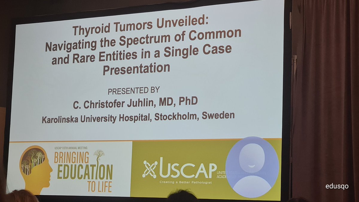 edusqo's tweet photo. Dr. Chistofer Juhlin @DrJuhlin at #USCAP2024 - rare case of a solitary fibrous tumor of the thyroid 👀.
DDx:
▫️Anaplastic thyroid carcinoma
▫️Spindle cell variant of MTC
▫️Angiosarcoma
#EndoPath https://t.co/d87rLpQZRY