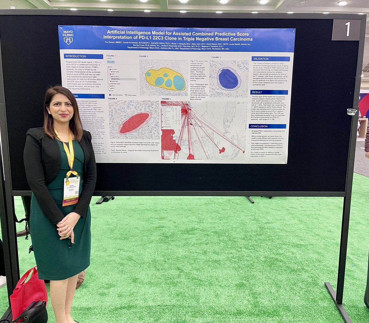 Stop by poster #1 to learn about our AI module for analyzing PD-L1 expression in triple-negative carcinoma
#USCAP #USCAP2024 #posterpresentation #firsttime #mayoclinic #pathtwitter #pathologyX #match2025 #pathtomatch #aapiringpathologist