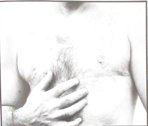 fagbianarchive's tweet photo. Chest Reconstruction: Subjects 1 and 2, Body Alchemy: Transsexual Portraits, by Loren Cameron, 1996 https://t.co/wE6D1uvd7W
