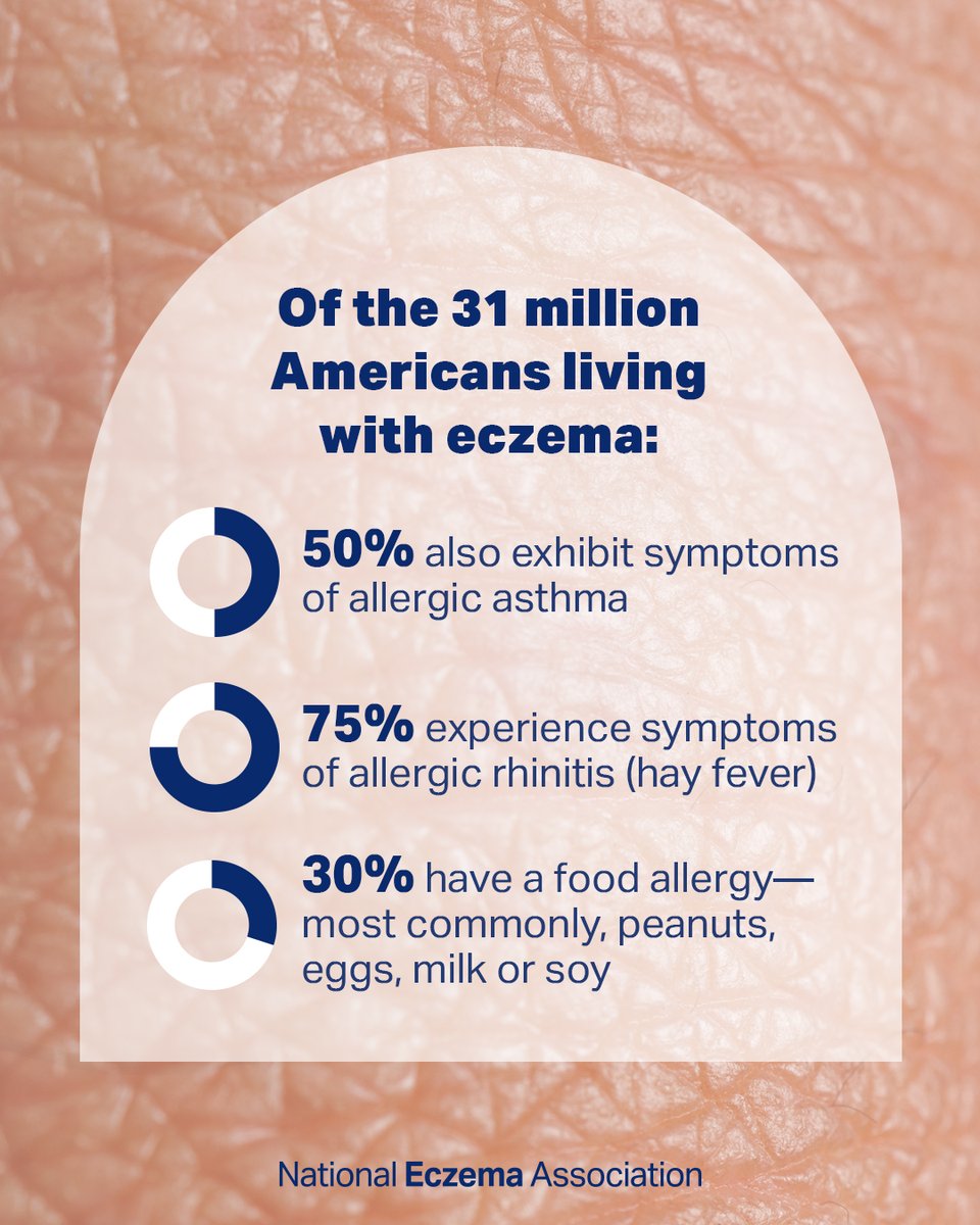nationaleczema's tweet photo. There’s more to #AtopicDermatitis than dry, itchy skin. 
➕ 
Read what an expert has to say about AD’s connection to #Asthma, #HayFever and #FoodAllergies: https://t.co/Y1wV77OTUD

#GetEczemaWise #unhideECZEMA https://t.co/kl8XTGI8aK