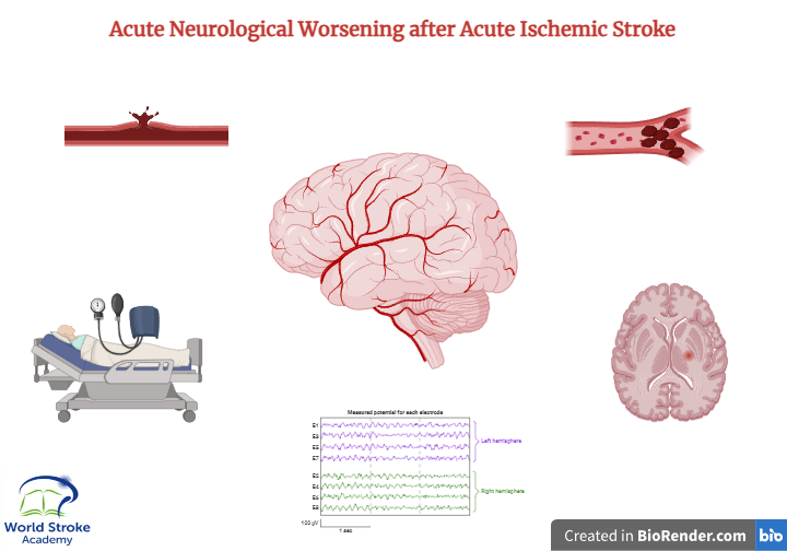 World Stroke Academy tweet media