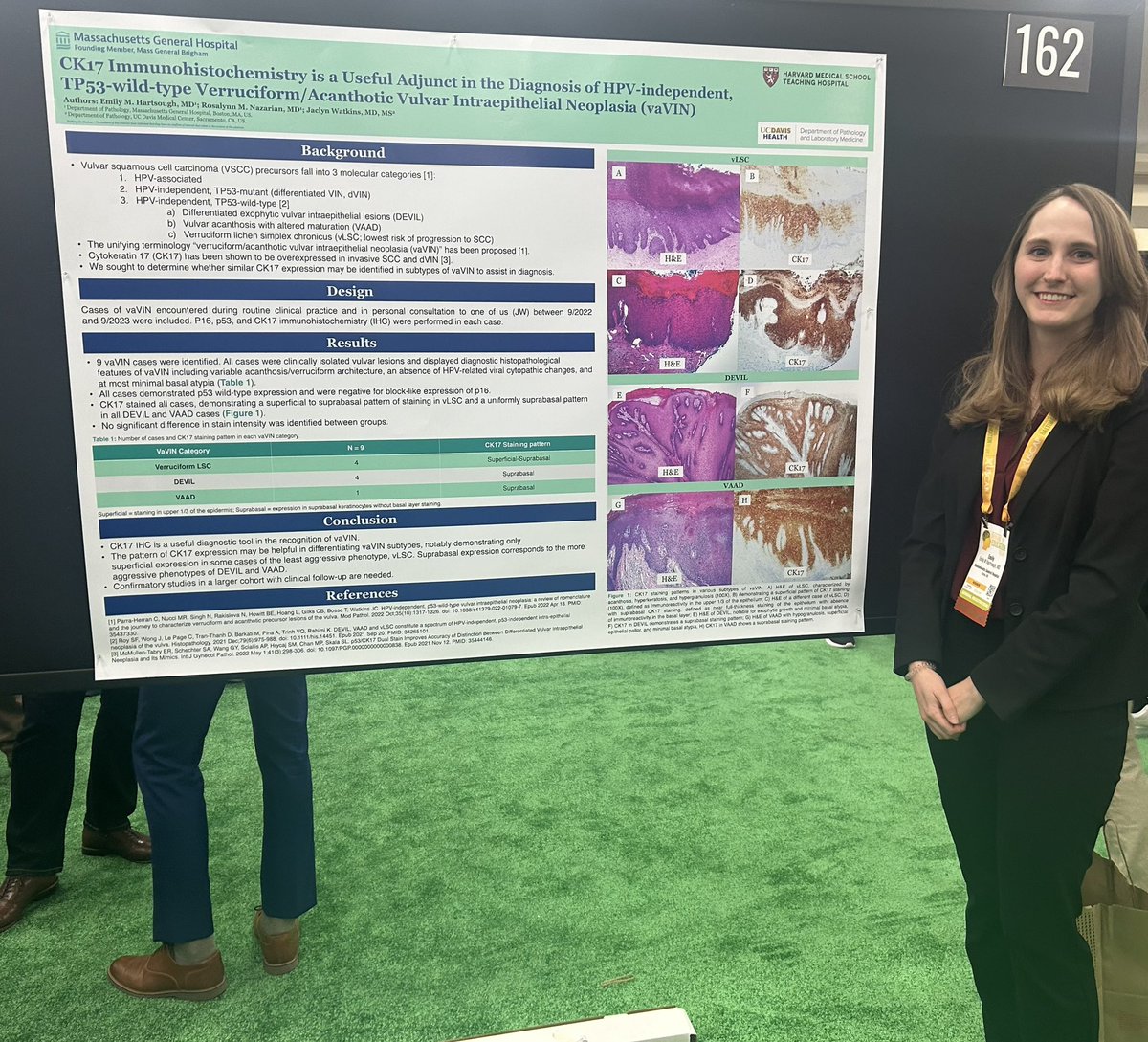 🔬Excellent work by our extraordinary @MGHPathology trainee @ehartso1 at #USCAP2024 👏 Great collaboration @JaclynWatkinsMD!