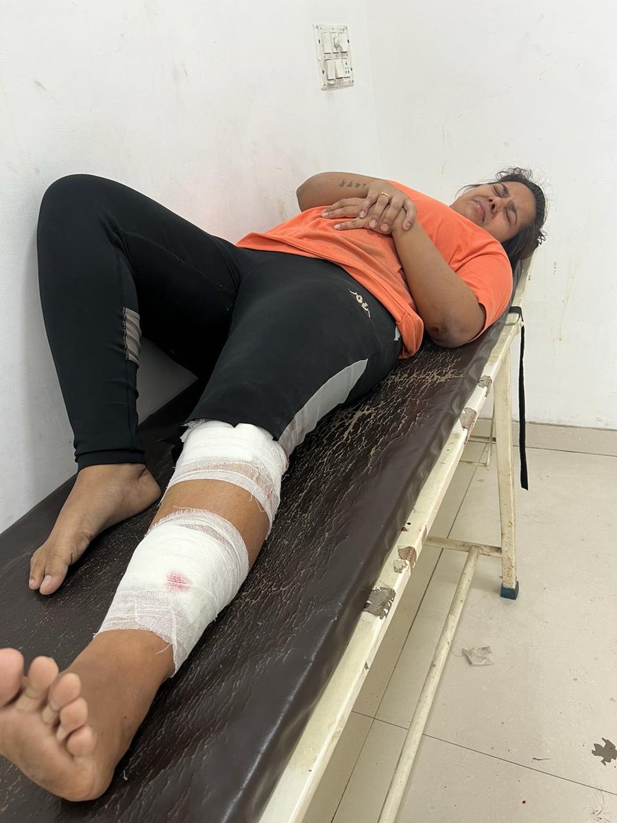 ThakurKaBeta's tweet image. गाजियाबाद के राज नगर एक्सटेंशन के #KDP सोसाइटी में कुत्तों का एक बार फिर दिखा आतंक। इस बार कुत्तों ने अपने फ्लैट जा रही युवती को अपना शिकार बनाया। सोसाइटी के अध्यक्ष और गाजियाबाद पुलिस साथ ही नगर निगम किसी के मरने का इंतेजार कर रहा है। सोसाइटी में अवारा कुत्तों की भरमार है।