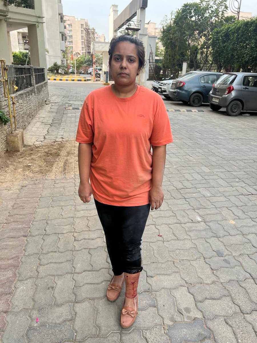 ThakurKaBeta's tweet image. गाजियाबाद के राज नगर एक्सटेंशन के #KDP सोसाइटी में कुत्तों का एक बार फिर दिखा आतंक। इस बार कुत्तों ने अपने फ्लैट जा रही युवती को अपना शिकार बनाया। सोसाइटी के अध्यक्ष और गाजियाबाद पुलिस साथ ही नगर निगम किसी के मरने का इंतेजार कर रहा है। सोसाइटी में अवारा कुत्तों की भरमार है।