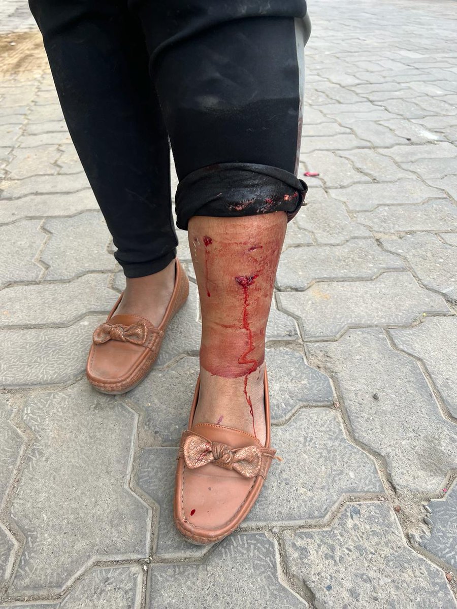 ThakurKaBeta's tweet image. गाजियाबाद के राज नगर एक्सटेंशन के #KDP सोसाइटी में कुत्तों का एक बार फिर दिखा आतंक। इस बार कुत्तों ने अपने फ्लैट जा रही युवती को अपना शिकार बनाया। सोसाइटी के अध्यक्ष और गाजियाबाद पुलिस साथ ही नगर निगम किसी के मरने का इंतेजार कर रहा है। सोसाइटी में अवारा कुत्तों की भरमार है।