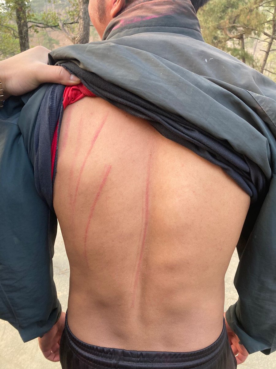 MayukhDuke's tweet photo. We are outraged by the brutal assault on North East Hill University students' union vice president, Easterson Sohtun by RSS/ABVP goons.
He was also subjected to casteist abuses.
We appeal to the student community of India to resist the fascists. Rise in rage against RSS bigotry. https://t.co/tF4Lu3eOG0