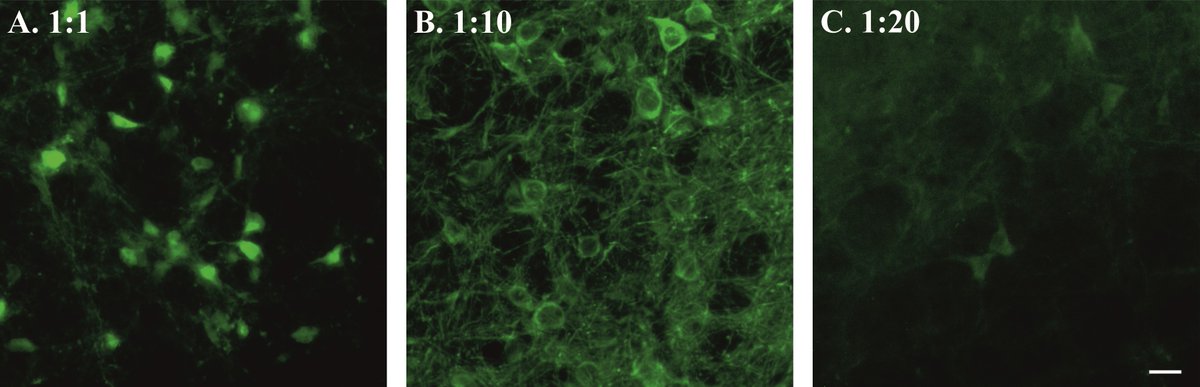 Delighted to share our bio-protocol that allows imaging from brainstem neurons and glia in freely behaving rodents. bio-protocol.org/e4973 Our imaging method paves way to image challenging brainstem structures to investigate their role. @EpilepsyInst @Inscopix @WarwickLifeSci