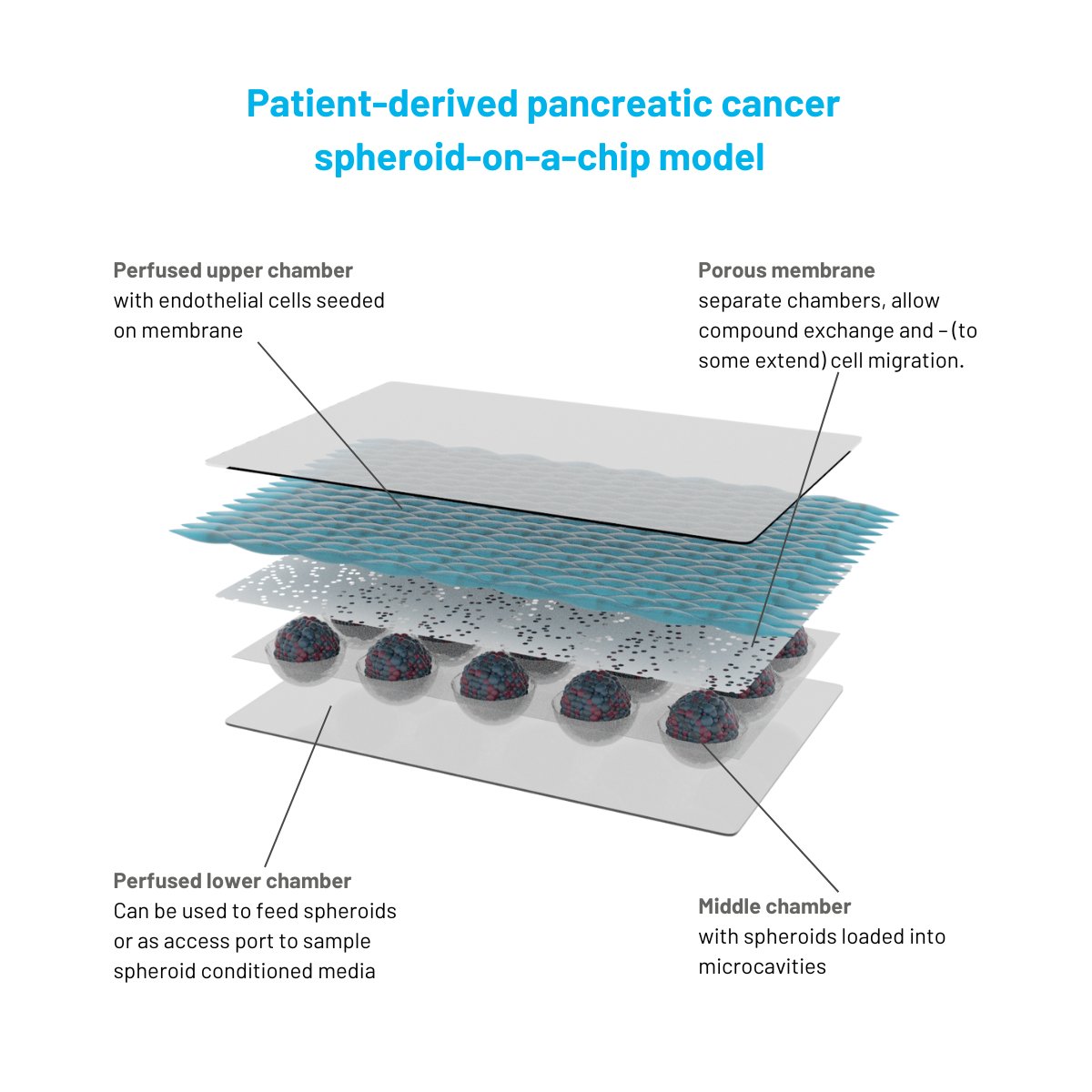 Advancing cancer immunotherapy requires realistic tumor microenvironment  models. Dynamic42's personalized pancreatic cancer spheroid-on-a-chip  models incorporate patient-derived TME, ensuring immunocompetence for  robust therapeutic screening. #CancerResearch #Immunotherapy