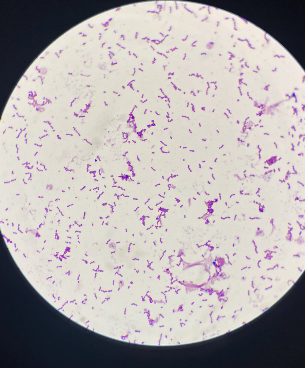 صباح الخير ✋

كيس على السريع 🤓

 Gram Stain for Blood🩸🔬

إيش تشوفوا؟ 🤔🤔