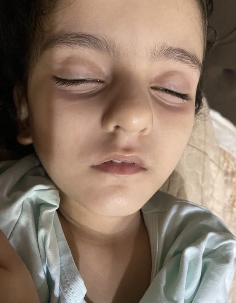 majjodaa1_'s tweet photo. قدّر الله ألا ينتهي المطاف🥹
أصدقائي أحتاج فزعتكم ومساعدتكم.

أنشأت رابط حملة تبرعات يغطي تكلفة النجاة من الحرب، السفر أو الموت.

آخر أمل، الله ثم أنتم السبيل 5 مليون شخص لدي أمل في نصفكم.

ملاحظة/العملة النرويجية(جداً منخفضة)20$=215kr
وبارك الله فيكم🤍

https://t.co/TSdWoKmQCg https://t.co/TYE1rx5PHF