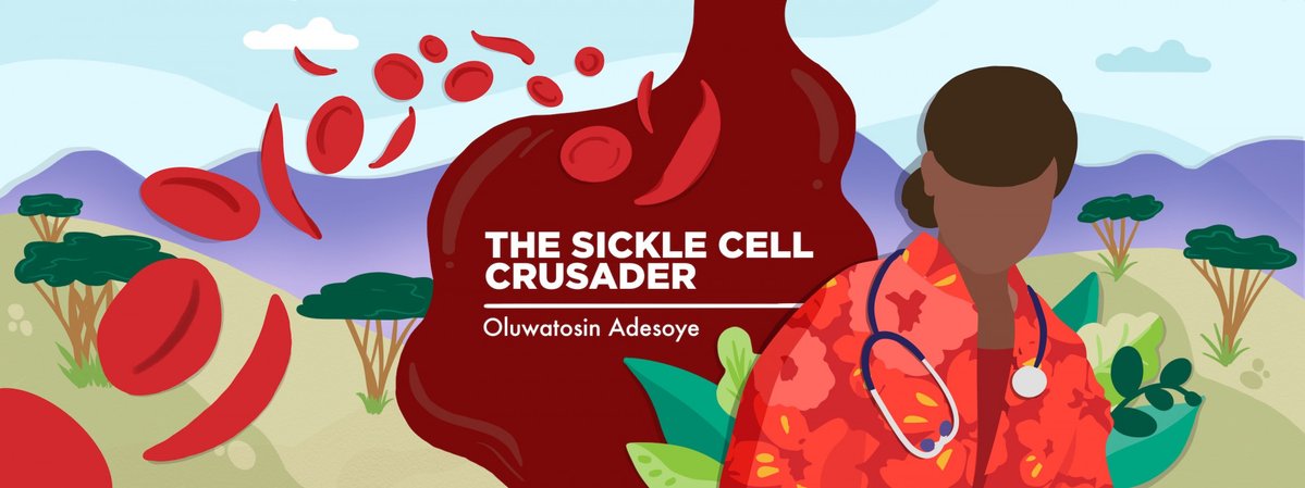 Navigating romantic relationships as a sickle cell patient 'Living with sickle cell disease presents unique challenges that can impact various aspects of one’s life, including romantic relationships' sicklecellanemianews.com/columns/naviga… via @sicklecell_news