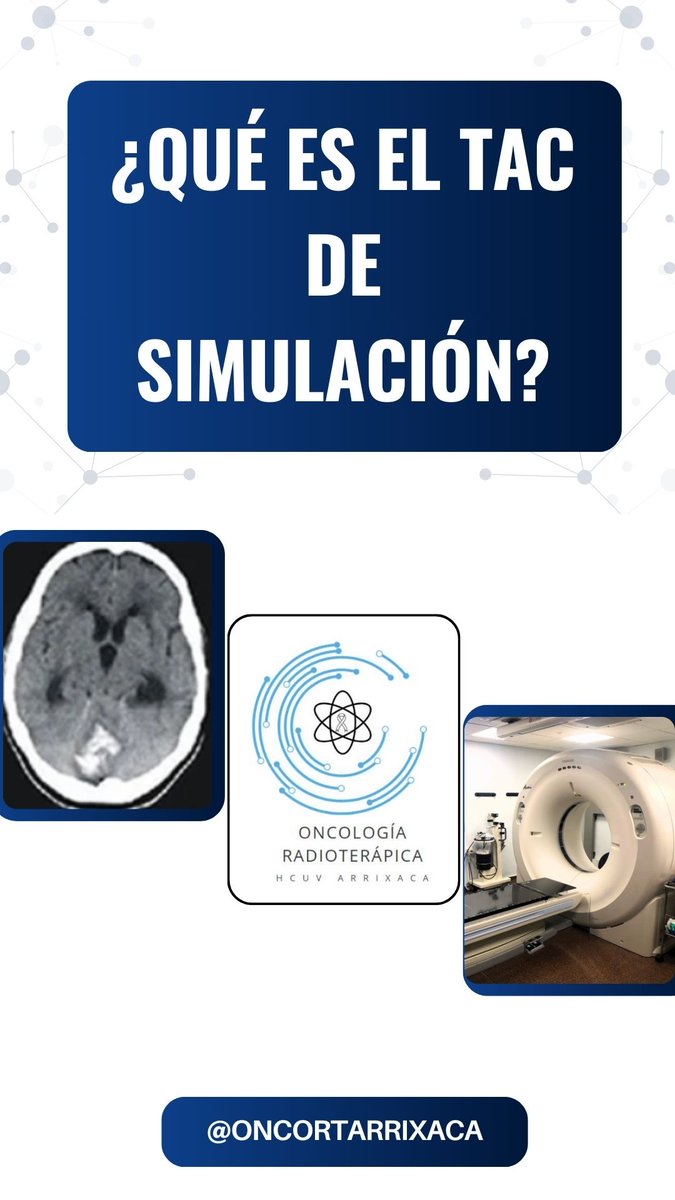 ¿Qué es el TAC de simulación? ☢️ El TAC es la herramienta fundamental para planificar tu tratamiento de radioterapia. Dale play al vídeo para saber más. ▶️ instagram.com/reel/C4-J73CtB…