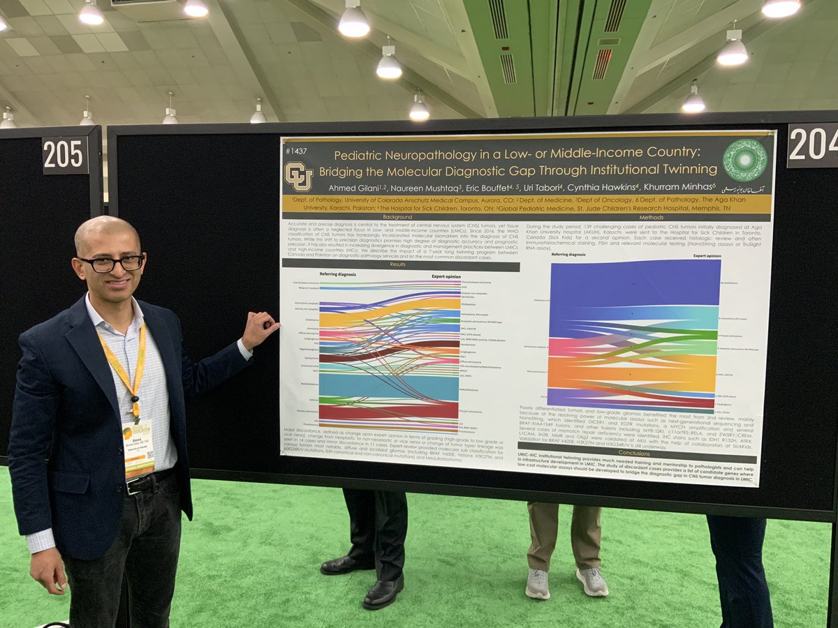 Poster at USCAP on <a href="/AKUGlobal/">Aga Khan University</a> <a href="/SickKidsGlobal/">SickKids Global Child Health</a> twinning for improving brain tumor diagnosis in Pakistan. <a href="/MushtaqNaureen/">Naureen Mushtaq</a>