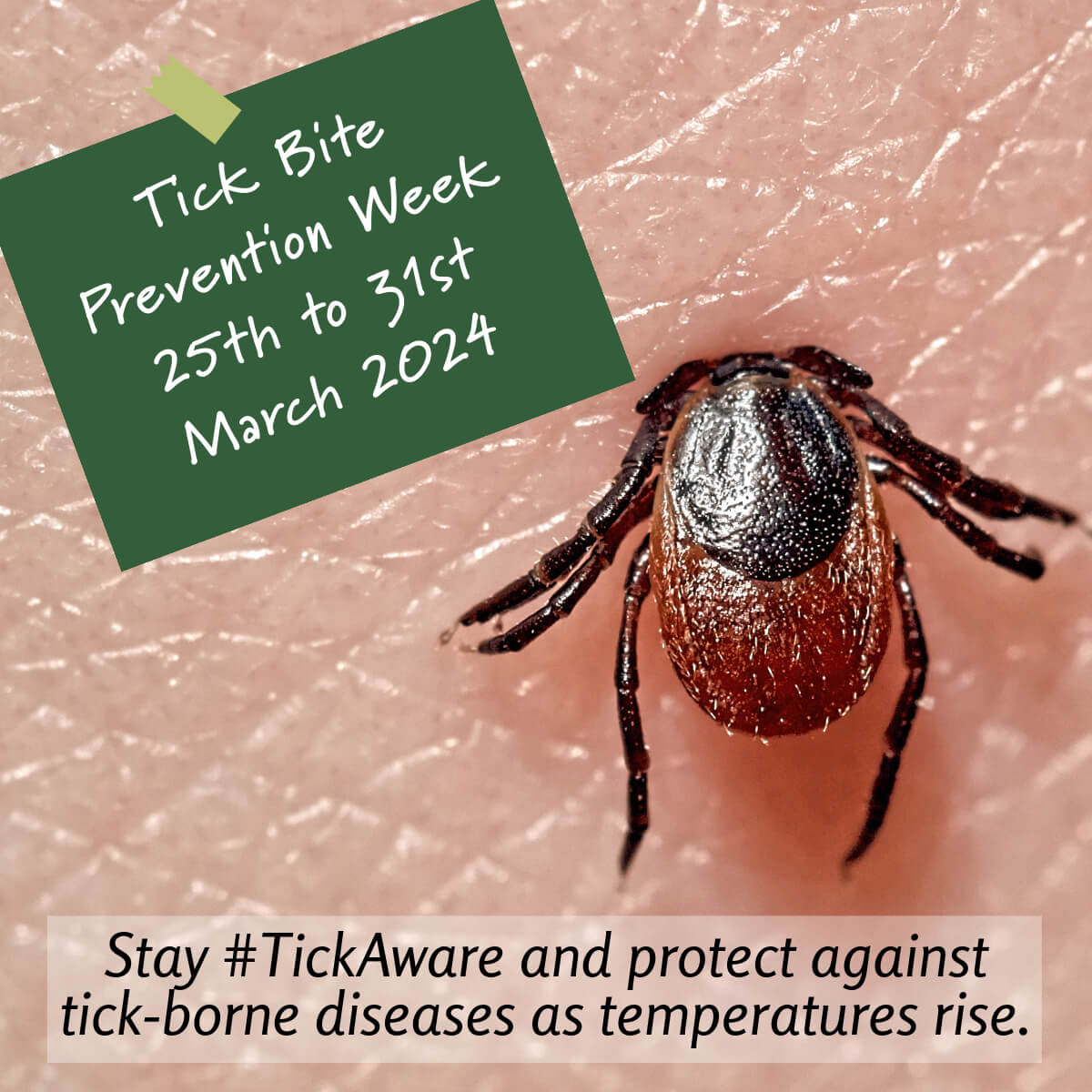 Stay safe this Tick Bite Prevention Week! As the weather heats up, so do tick dangers. Arm yourself with knowledge and protection to keep you and your loved ones tick-free. #TickAware #PreventionIsKey  #TickBitePreventionWeek #TickDangers #StaySafe #OutdoorSafety