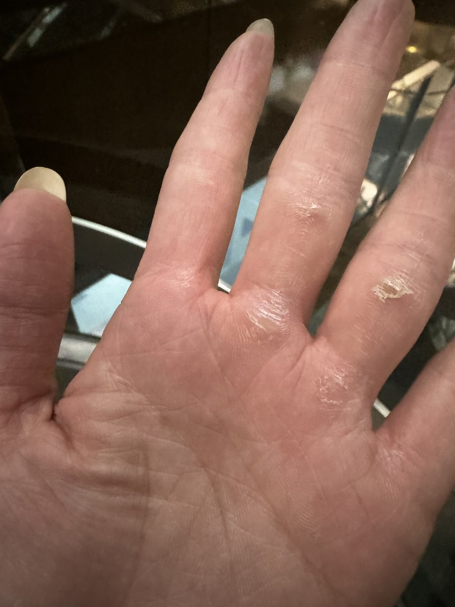 最近洗臉感覺在用菜瓜布刷臉😱
這樣幫男生尻會怎麼樣？ https://t.co/69fDcKZY8X