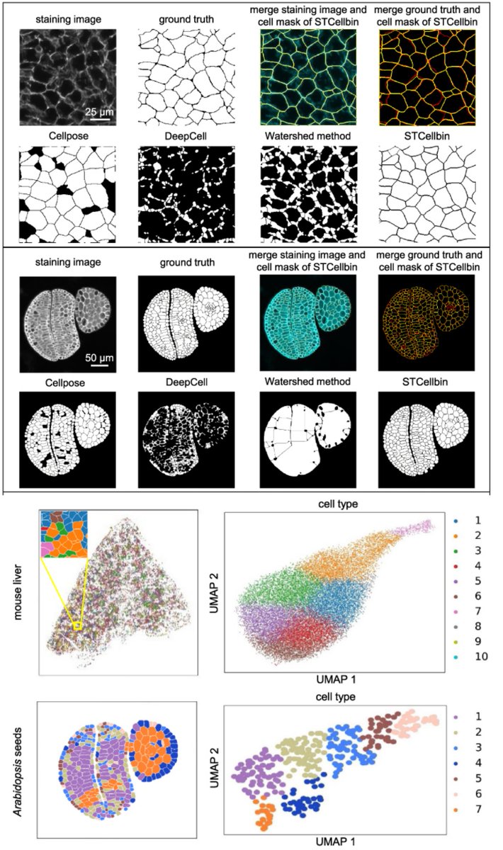 STCellbin Use Nuclei+Cell Membrane/Wall stains to improve #CellSegmentation & single-cell-resolved #SpatialTranscriptomics Tailored for #StereoSeq, but likely implementable for other ST methods Susanne Brix & Xun Xu labs @GigaByteJournal 2024 gigabytejournal.com/articles/110