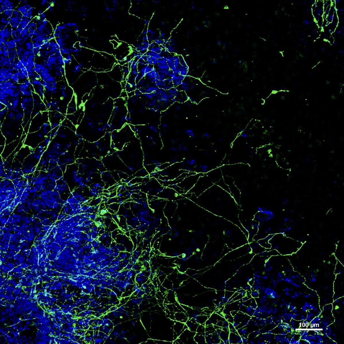 Late #microscopymonday ⁦with #neuronal connections #stemcells @NikonInst⁩ ⁦@confocal_nl⁩ ⁦@Sci_Art⁩ ⁦@BioElife⁩