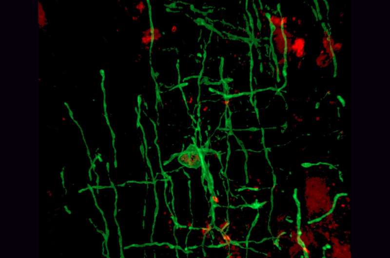 ¿Qué tienen en común la mielina y los virus? Ven, te voy a platicar... La mielina es una capa aislante, o vaina, que se forma alrededor de los nervios, incluso los que se encuentran en el cerebro y la médula espinal. Está compuesta de proteínas y sustancias grasas y permite 1/