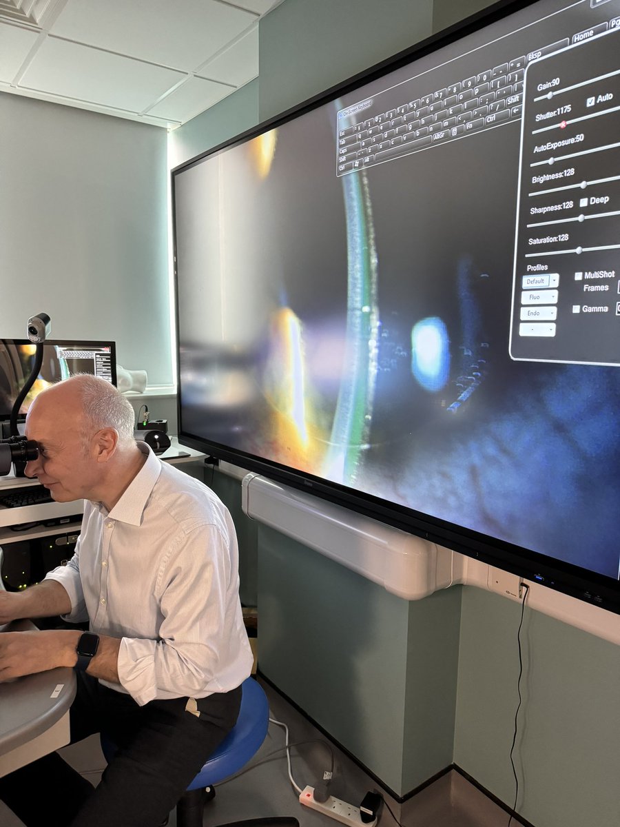 Mahesh R Joshi || PhD || (@mrj_vision) on Twitter photo Last week our final year students <a href="/PlymOptometry/">OptometryWithPlymUni</a> had hands-on experience in fitting and assessing mini-scleral contact lens. Thanks to Ian Sexton from <a href="/CooperVisionUK/">CooperVision UK</a> in helping to run this workshop. #miniscleral #specialitycontactlens Last week our final year students <a href="/PlymOptometry/">OptometryWithPlymUni</a> had hands-on experience in fitting and assessing mini-scleral contact lens. Thanks to Ian Sexton from <a href="/CooperVisionUK/">CooperVision UK</a> in helping to run this workshop. #miniscleral #specialitycontactlens