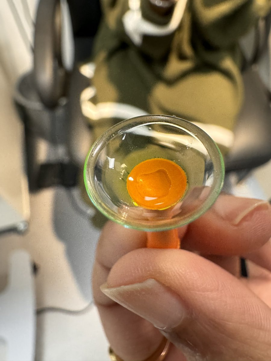 mrj_vision's tweet image. Last week our final year students @PlymOptometry had hands-on experience in fitting and assessing mini-scleral contact lens. Thanks to Ian Sexton from @CooperVisionUK in helping to run this workshop. #miniscleral #specialitycontactlens